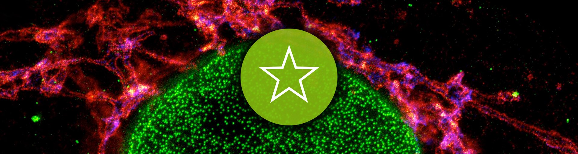 abberior STAR