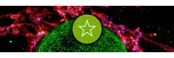 abberior STAR