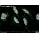abberior STAR GREEN, phalloidin, 20 µg