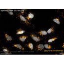abberior STAR ORANGE, phalloidin, 20 µg