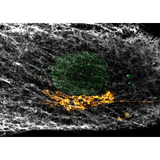 abberior CELLS 3 color
