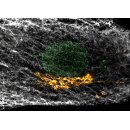 abberior CELLS 3 color
